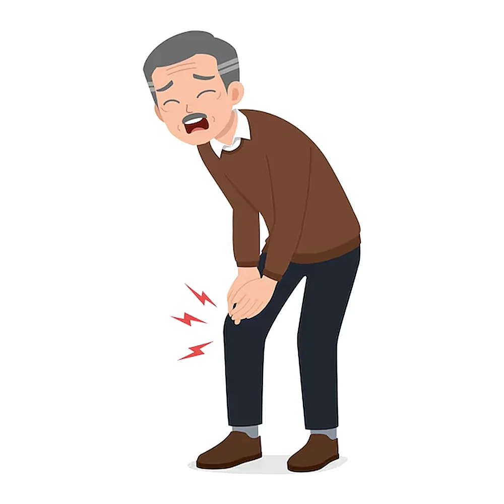 Illustration showing osteoarthritis