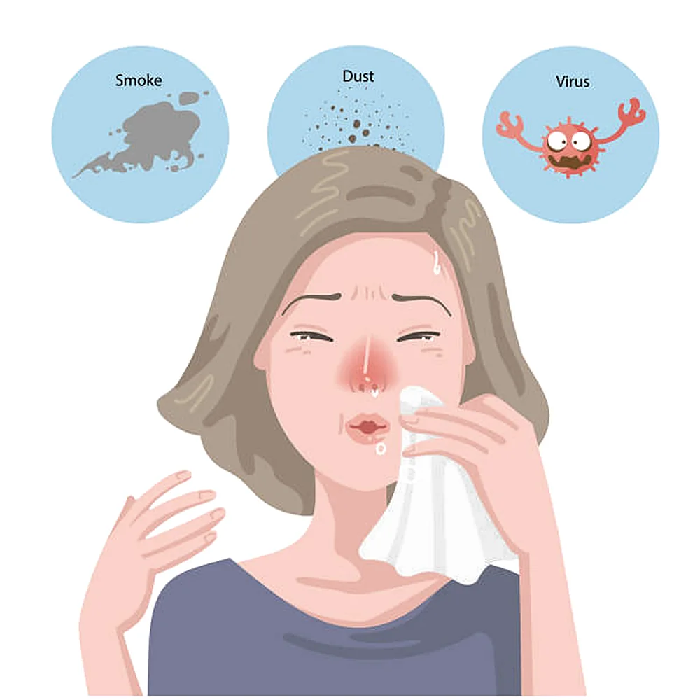 Illustration showing sinusitis