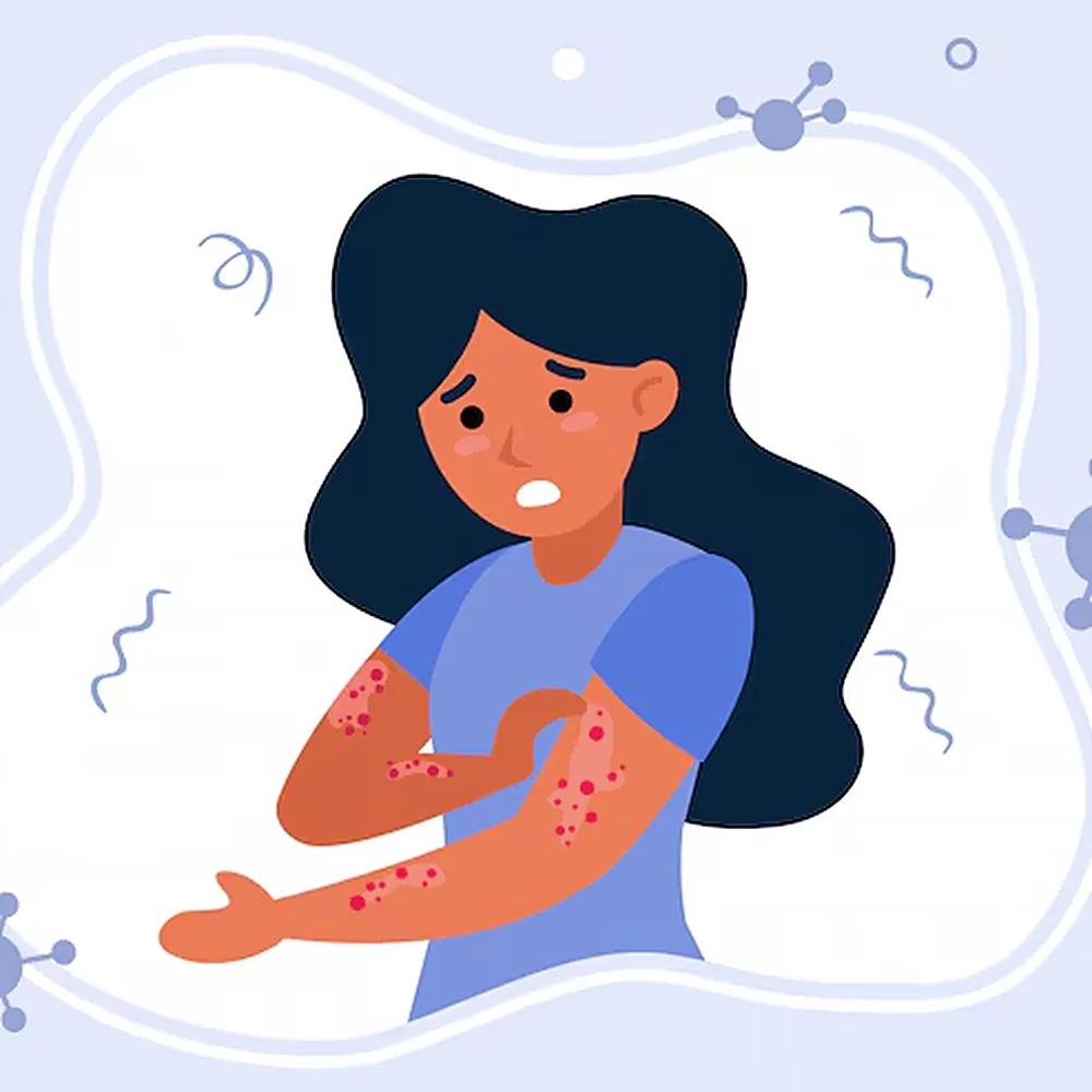 Illustration showing skin diseases